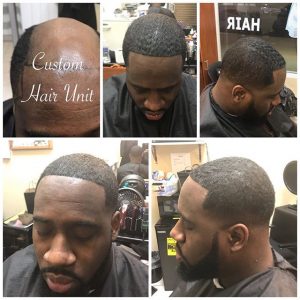 Hair Replacement at “Miracles Beauty and Barber Salon” in District ...